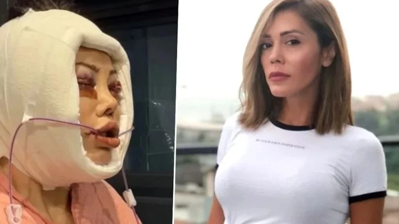 Didem Ceran'dan Cesur Sağlık Açıklaması